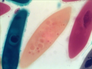 Paramecium taken by AxioVision with Best Fit at Low Light Condition
