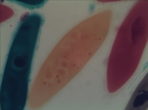 Paramecium taken by AxioVision at Normal Light Condition